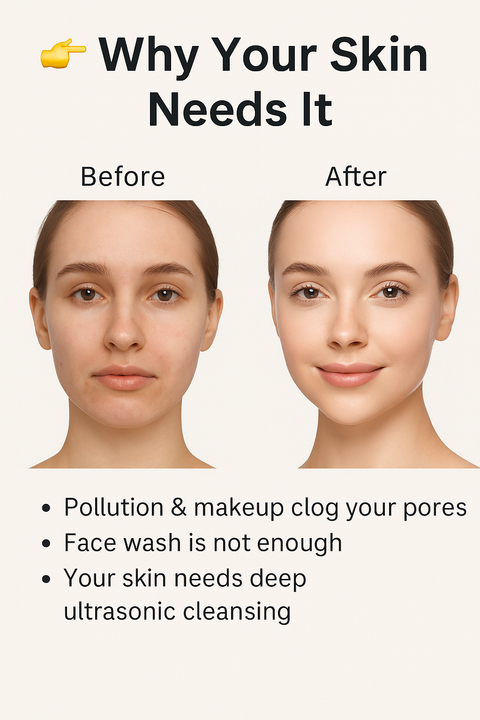 Ultrasonic Facial Skin Scrubber